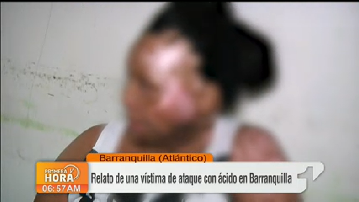 «Me quemó para que no fuera de nadie más”, mujer quemada con ácido