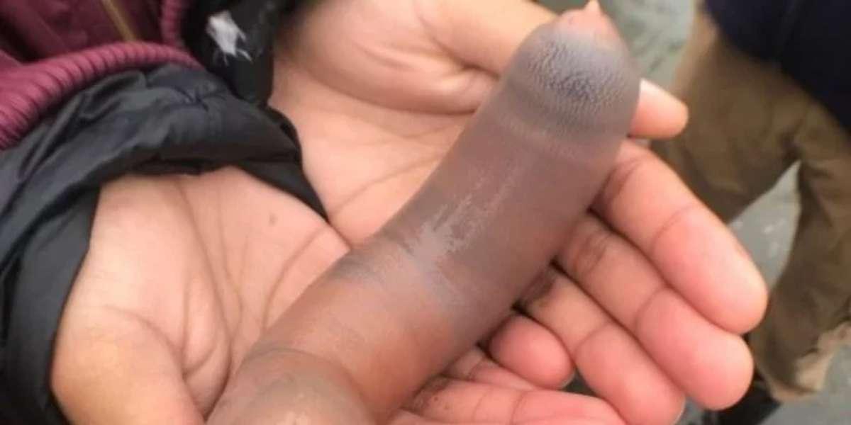Miles de peces pene desconcertaron a la gente con su repentina aparición en la playa